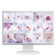 Иммуноцитохимические исследования Vision Cyto Pap ICC