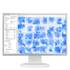 Диагностика заболеваний, передающихся половым путем Vision Cyto STD